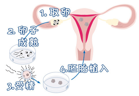IVF实验室